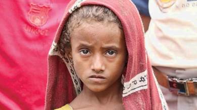 طفلة يمنية تعاني مع أسرتها من آثار الحرب التي أشعلتها الميليشيات الحوثية